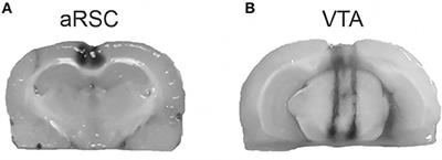 Dopamine D1/D5 Receptors in the Retrosplenial Cortex Are Necessary to Consolidate Object Recognition Memory